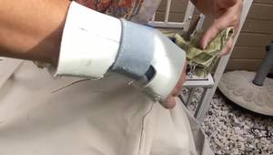 DIY: Reinforce and Repair a Torn Outdoor Umbrella Cover